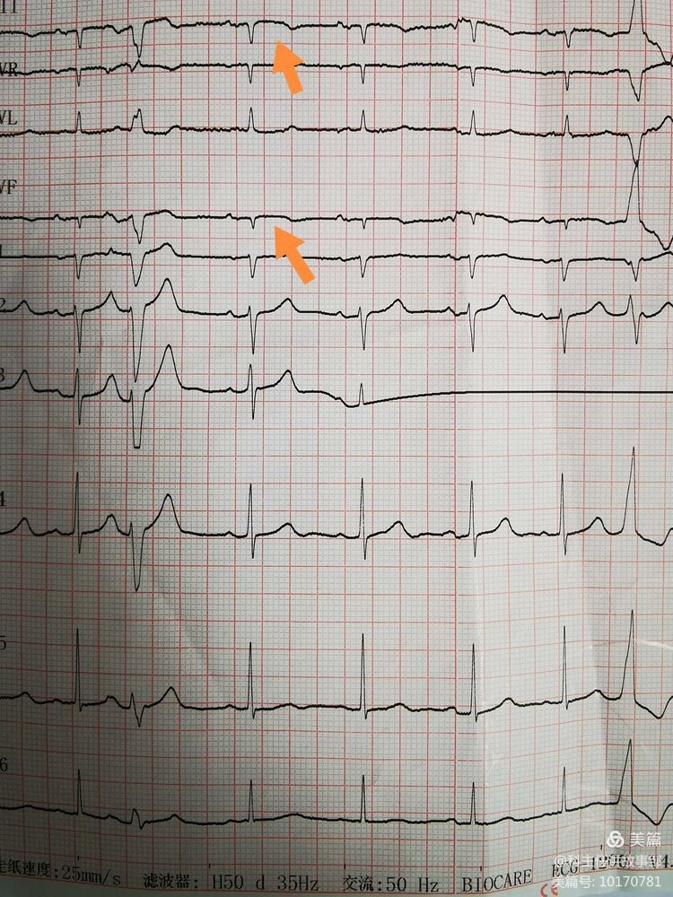 1614992480363138.jpg 22.jpg